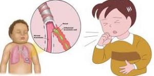 obat tradisional batuk pilek pada anak